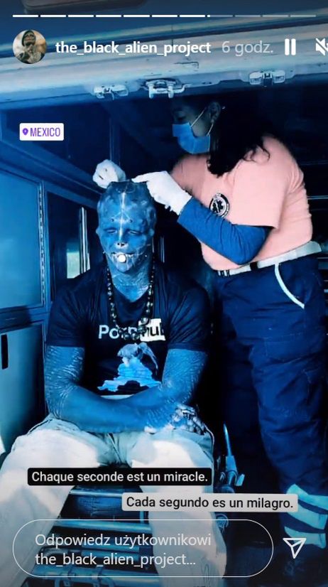 Mężczyzna został poddany badaniom 