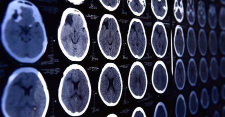 Wielka Brytania: 20-latek otrzymał druzgocącą diagnozę. "Czułem najgorszy ból głowy"