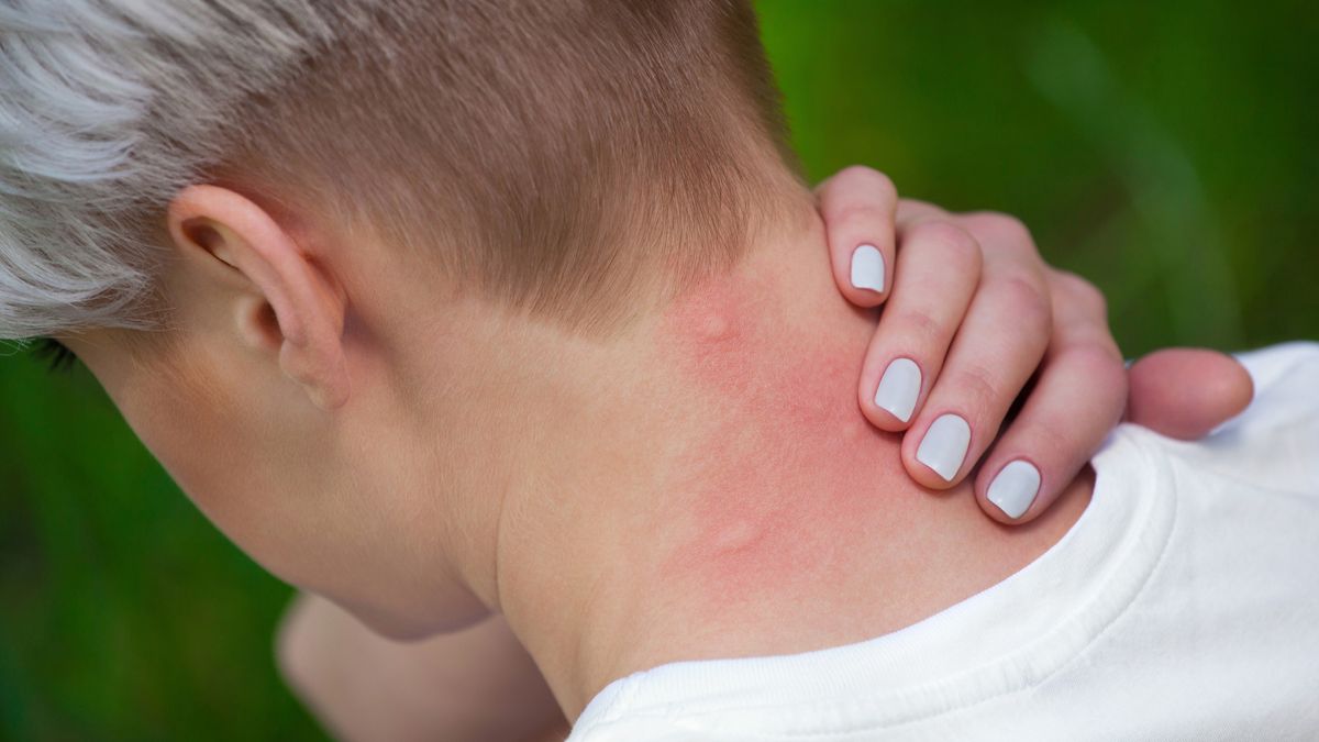 Komary i meszki potrafią uprzykrzyć życie