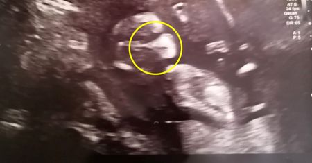 Ciężarna kobieta, chora na COVID-19, zrobiła USG. Niesamowite zdjęcie