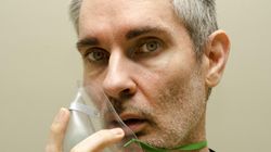 Pulmunolog o nowych przyczynach raka płuc. Mówi, kto teraz choruje częściej