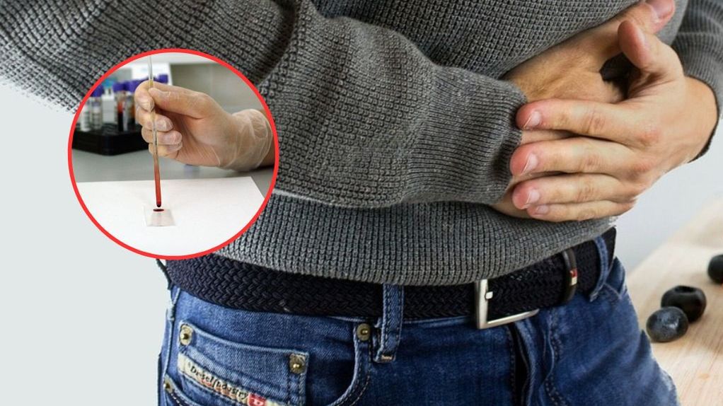 Mało charakterystyczne objawy raka jelita grubego. Koniecznie się zbadaj, jeśli nie ustępują