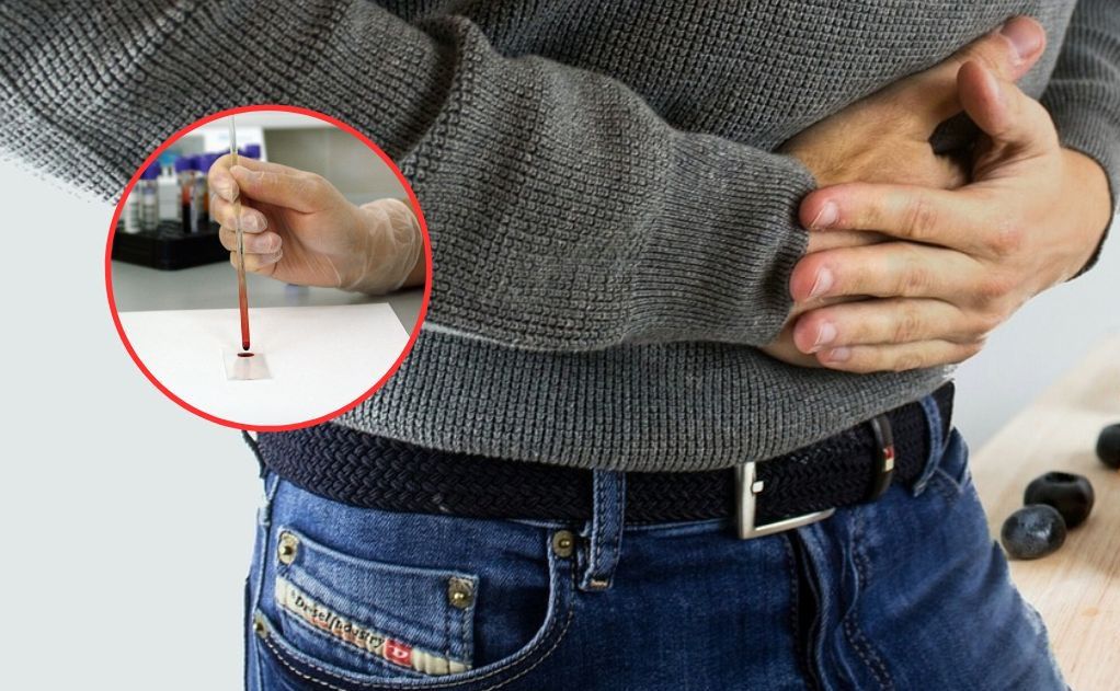 Bardzo wczesny objaw raka jelit. Coraz częściej atakuje młodych