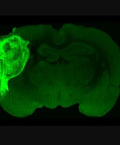 Miniaturowe ludzkie mózgi wszczepione szczurom