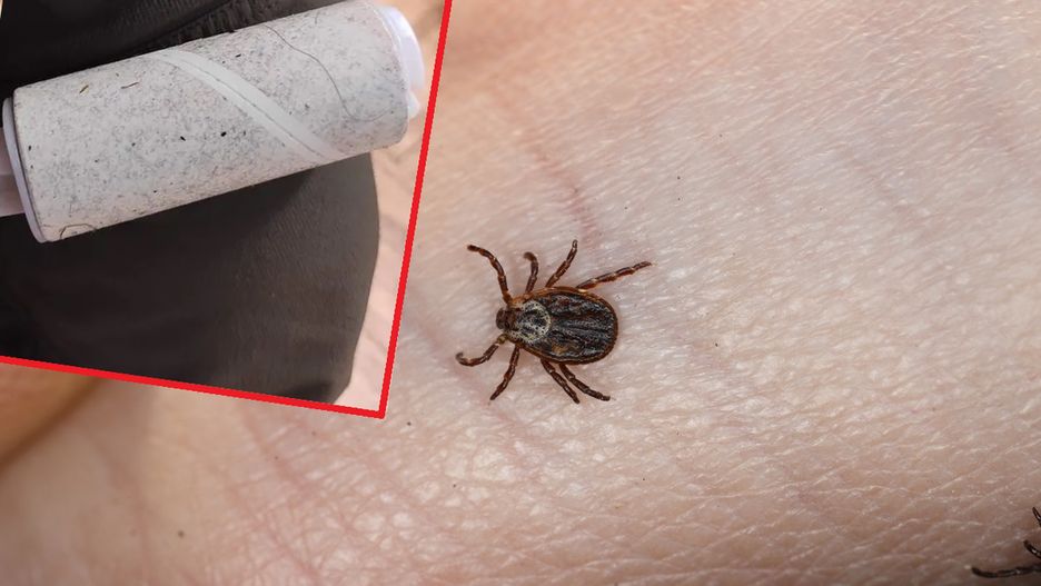 Tani i prosty sposób na pozbycie się kleszczy z ubrań