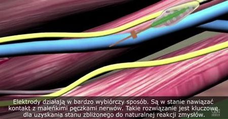Mechaniczne ramię pozwala pacjentom czuć dotykane przedmioty
