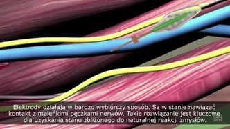 Mechaniczne ramię pozwala pacjentom czuć dotykane przedmioty