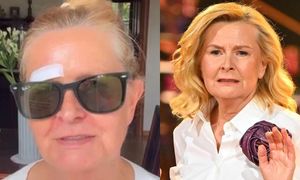 Barbara Bursztynowicz upadła na ulicy i rozcięła łuk brwiowy! "KREW TRYSKAŁA. (...) Przechodziło mnóstwo osób. Nikt się nie zatrzymał"