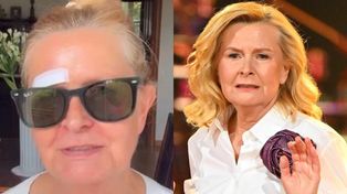 Barbara Bursztynowicz upadła na ulicy i rozcięła łuk brwiowy! "KREW TRYSKAŁA. (...) Przechodziło mnóstwo osób. Nikt się nie zatrzymał"