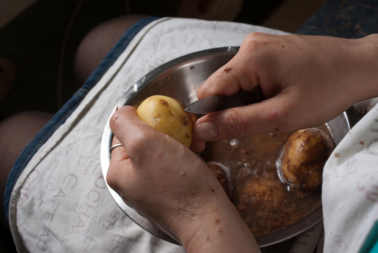 If the potatoes are greenish and sprouting, they are not suitable for eating.