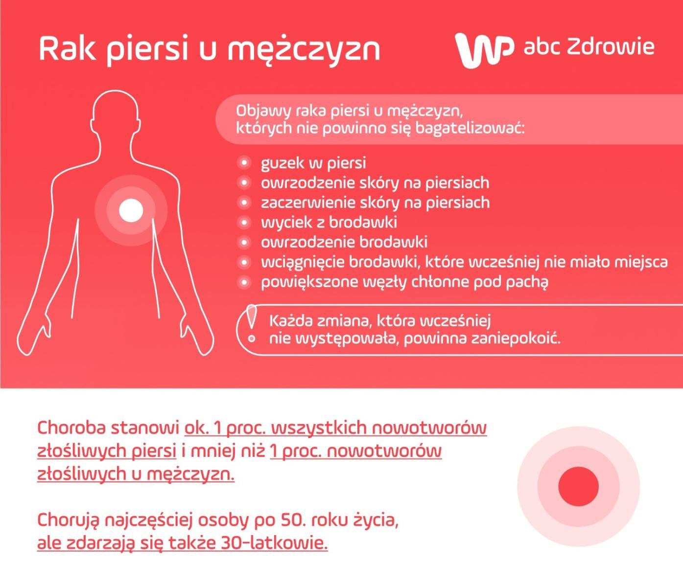 Objawy raka piersi u mężczyzn