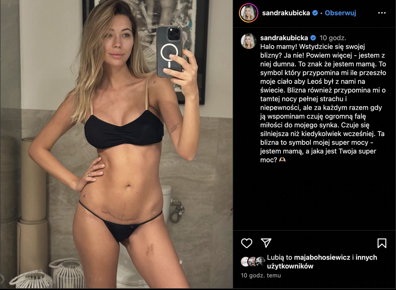 Sandra Kubicka pokazała bliznę po cesarce. 