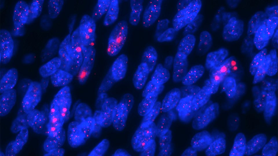 Zombie-apokalipsa nadchodzi?! 1