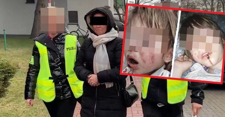 Matka z piekła rodem. Oszpecała córkę substancją żrącą
