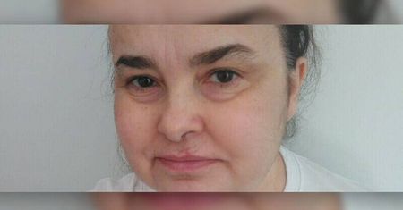 Walczy z nowotworem złośliwym mózgu. Apel o pomoc dla pani Agnieszki Szpak