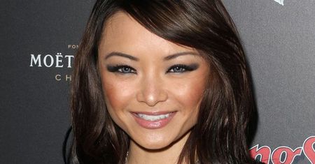 Tila Tequila bliska śmierci! Gwiazda z tętniakiem mózgu walczyła o życie!
