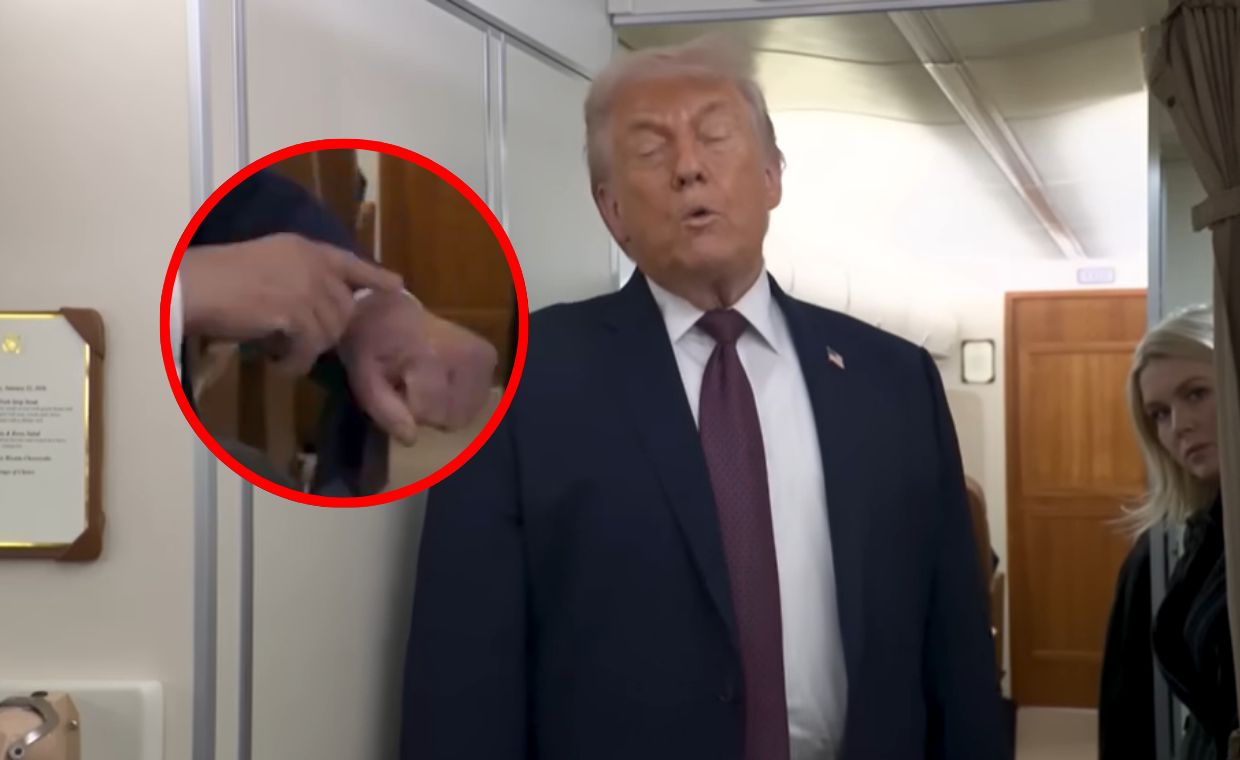 wiadomości,aktualności,WP Wiadomości Trump o siniaku na dłoni. Wskazał na wydarzenia w Davos