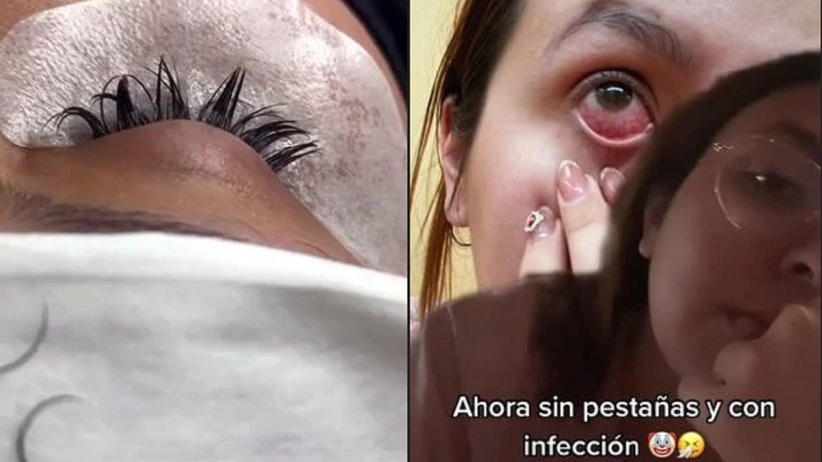 TikTokerka pokazała efekty zabiegu.