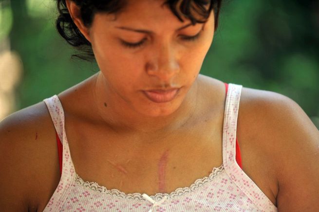 Porażająca skala przemocy wobec kobiet w Ameryce Łacińskiej
