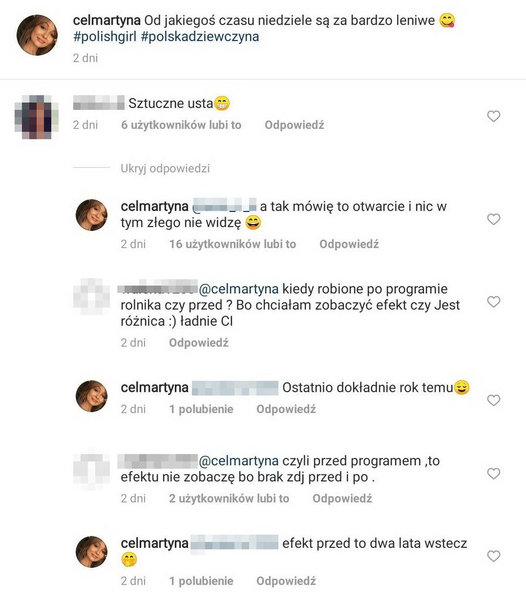 Martyna Cel przyznaje się do powiększenia ust