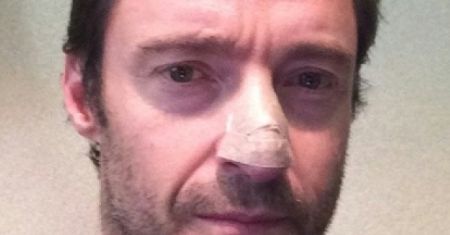 ''Wolverine'': U Hugh Jackmana zdiagnozowano raka