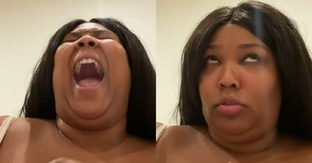 Lizzo próbowała zdjąć plaster przez 2 dni. Nagranie okazało się hitem Internetu