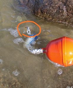 Kołobrzeg. SOR i szycie nogi po spacerze w wodzie. Kierownik kąpieliska wyjaśnia, skąd się wzięły metalowe pręty w Bałtyku