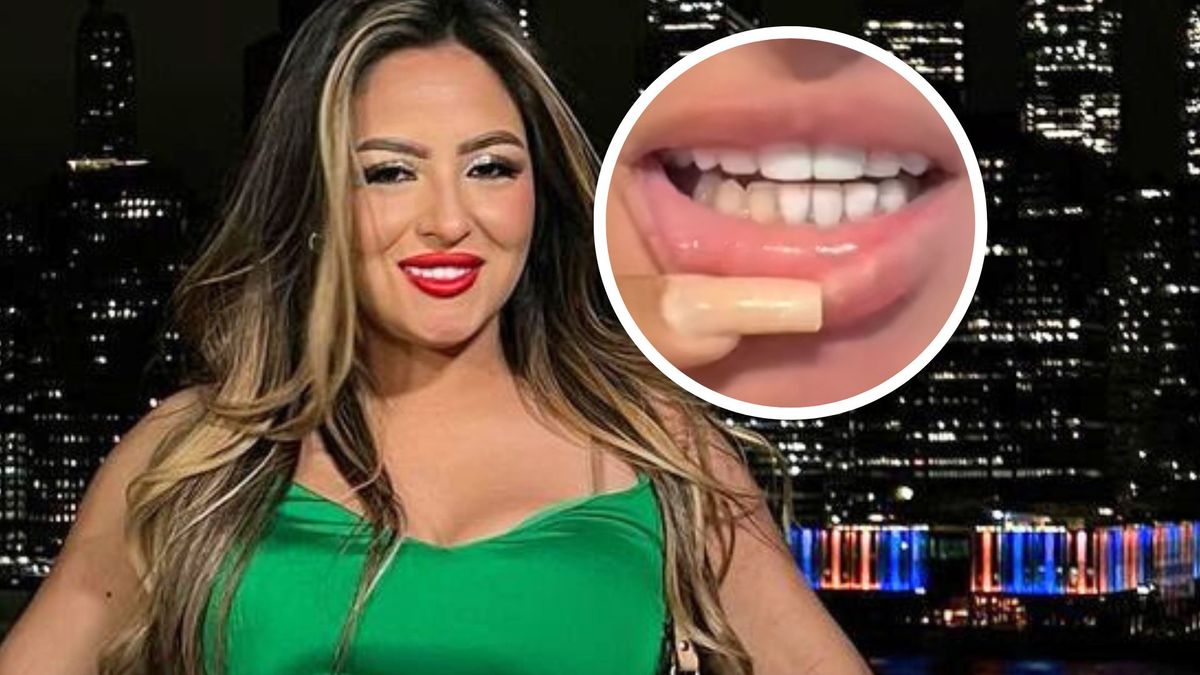 "Meksykańskie zęby"