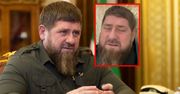 Dziwnie odmieniony Ramzan Kadyrow wysyła syna do Putina. Czy to koniec jego władzy?