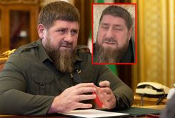 Dziwnie odmieniony Ramzan Kadyrow wysyła syna do Putina. Czy to koniec jego władzy?
