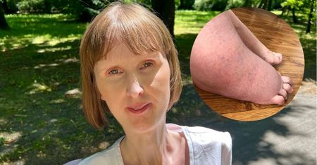 Joanna staje się żywym posągiem. Z FOP rodzi się jedna osoba na milion