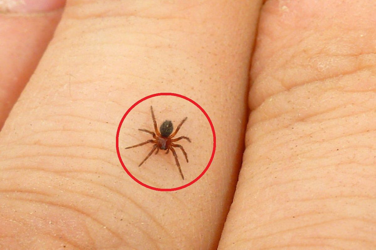 Brown Recluse Spider Bite - JETem