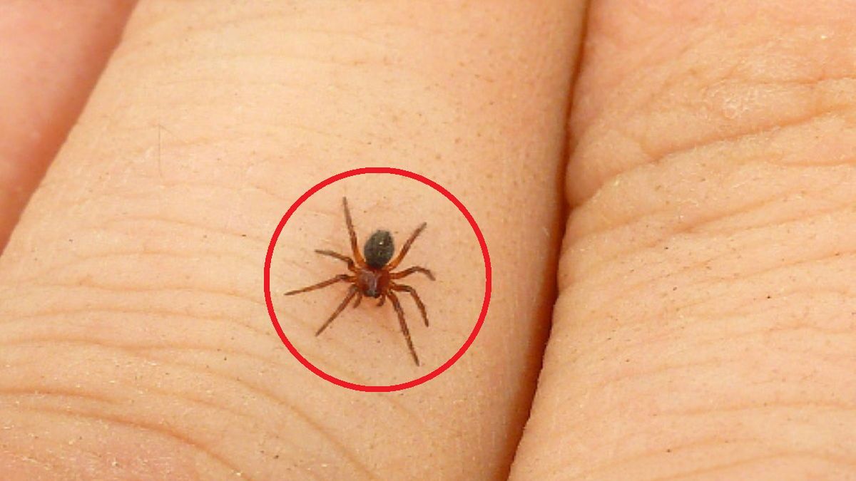 39-latka sądziła, że wyskoczył jej pryszcz na pośladku. W rzeczywistości znajdowała się w śmiertelnym niebezpieczeństwie 