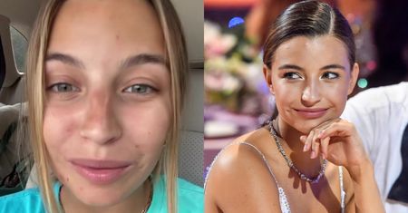 Julia Wieniawa relacjonuje "RENOWACJĘ TWARZY" po wakacjach z Nikodemem: "Jejku, jak ja wyglądam..." (FOTO)