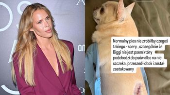 Koszmar na spacerze w Gdyni. Zuzanna Pactwa miała do czynienia z agresywnym czworonogiem: "Normalny pies nie zrobiłby czegoś takiego"