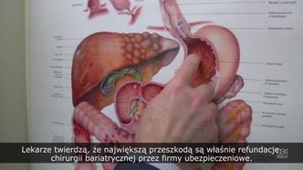 Wielkie zalety i wciąż utrudniony dostęp do chirurgicznej walki z otyłością