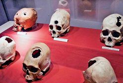 Medycyna dawnych Inków: Zaawansowane metody chirurgiczne i rozpoznanie dzięki świnkom morskim