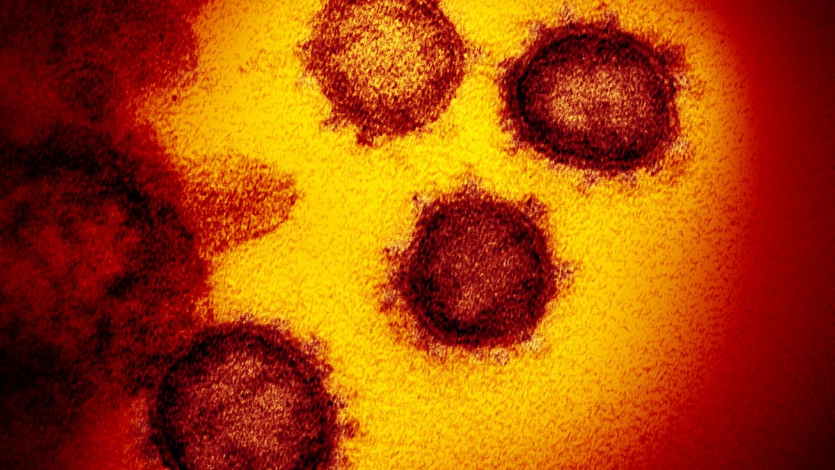 Jak powstają zdjęcia koronawirusa SARS-CoV-2? Zobacz jego różne oblicza 1