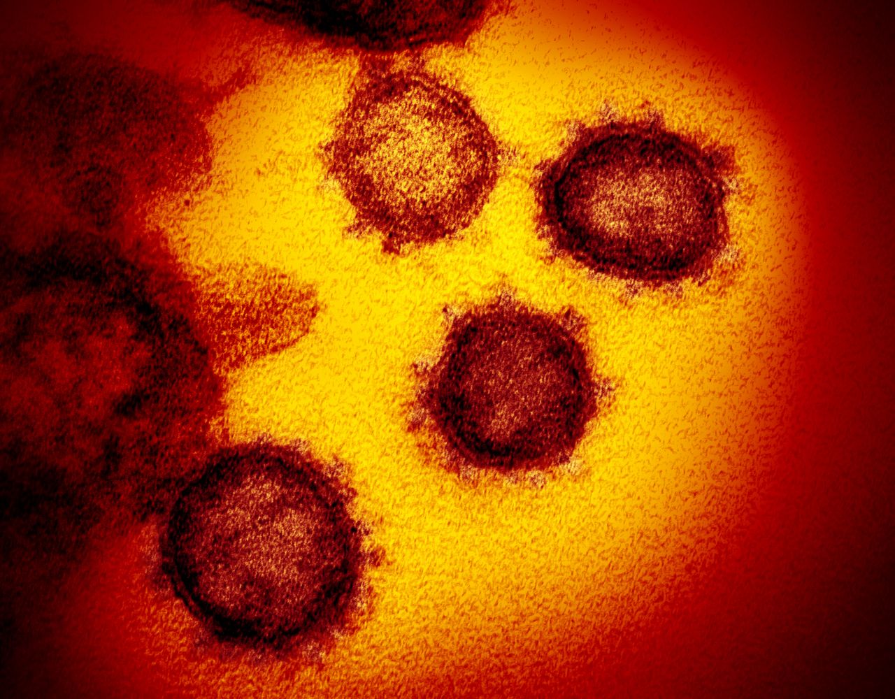 Jak powstają zdjęcia koronawirusa SARS-CoV-2? Zobacz jego różne oblicza