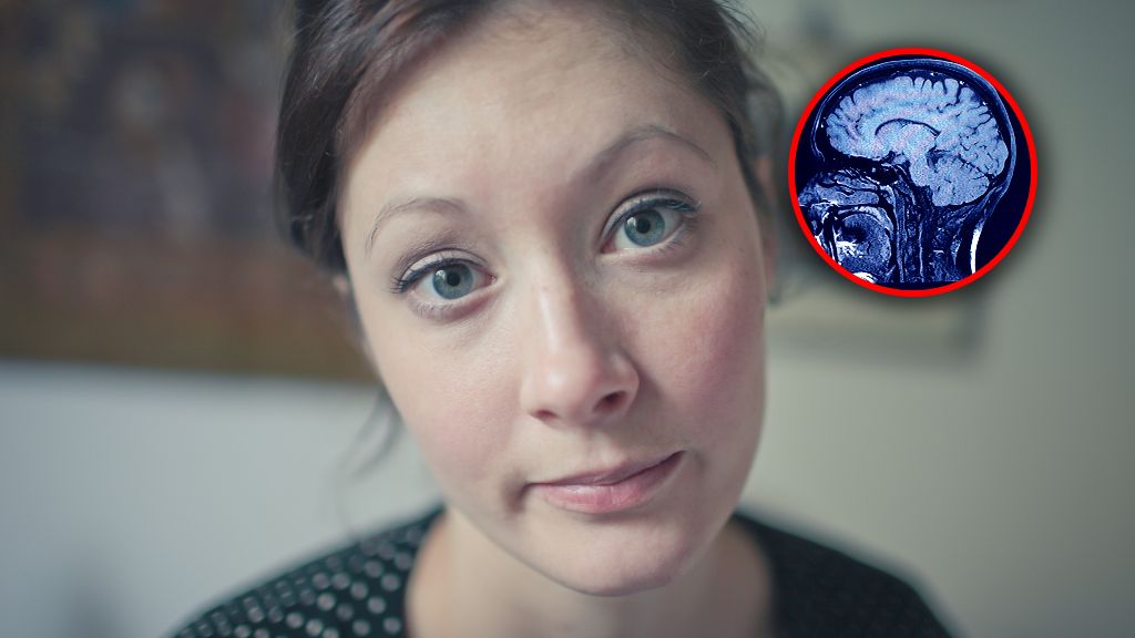 18 marca obchodzimy Europejski Dzień Mózgu