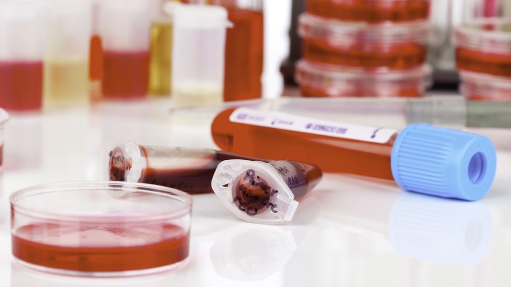 Pierwsze badania w diagnostyce białaczki