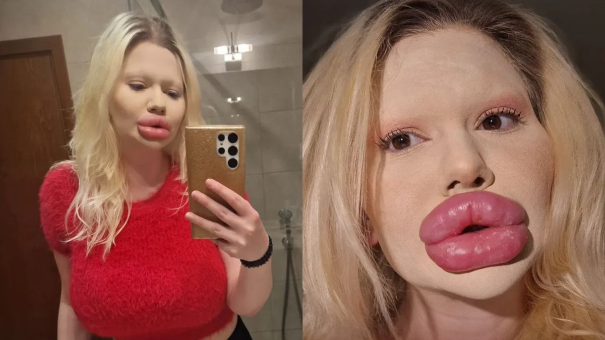 "Bułgarska Barbie" zapragnęła mieć największe usta na świecie
