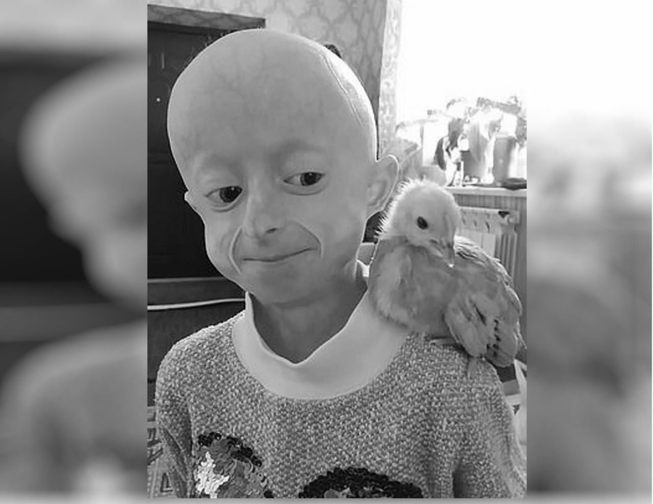 10-latka w ciele 80-latki. Zmarła Irina Chimich