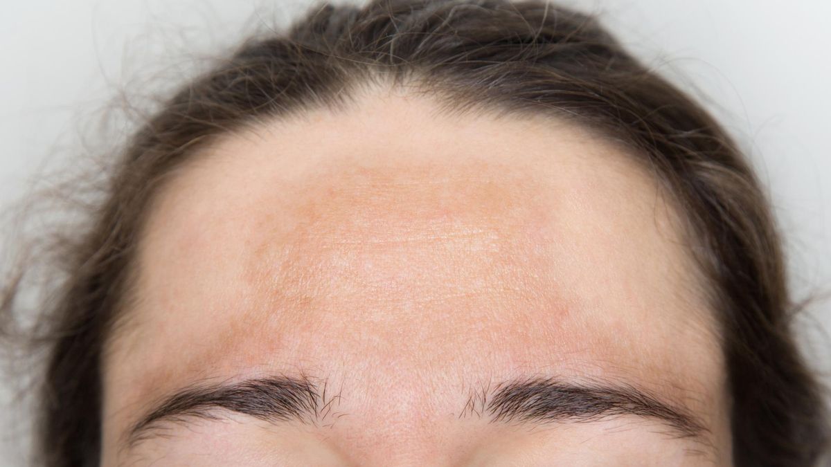 Plamy na ciele mogą być spowodowane przez urazy, używanie niewłaściwych kosmetyków, ale także mogą być objawem chorób