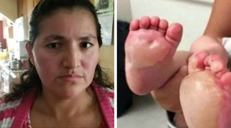 Półroczna dziewczynka doznała poparzeń 2 stopnia, wszystko przez swoją nianię, 36-letnią Ismeldę Ramos Mendozę