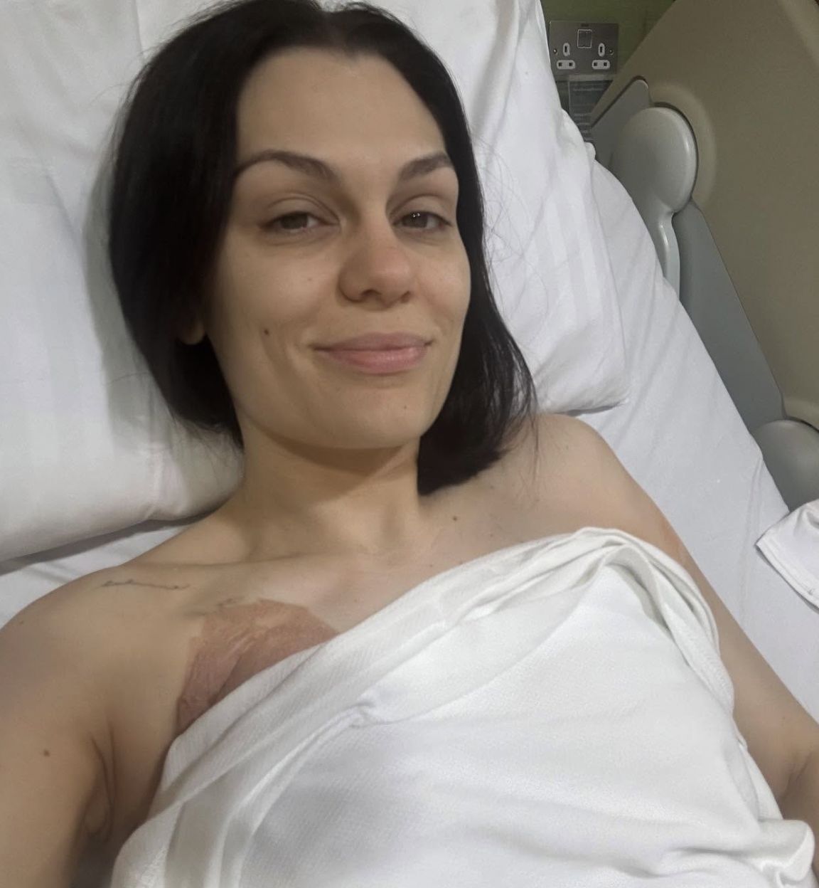 Jessie J tuż po operacji