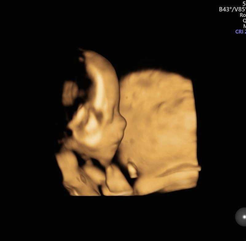 Joanna Krupa pokazała zdjęcie dziecka z badania USG, widać główkę
