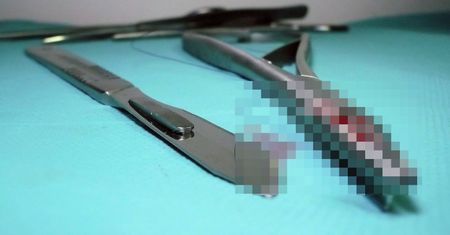 Zaatakował nożyczkami na oddziale covidowym. Nie żyje pacjentka