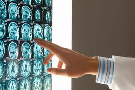 Obrzęk mózgu – charakterystyka, przyczyny, objawy, leczenie