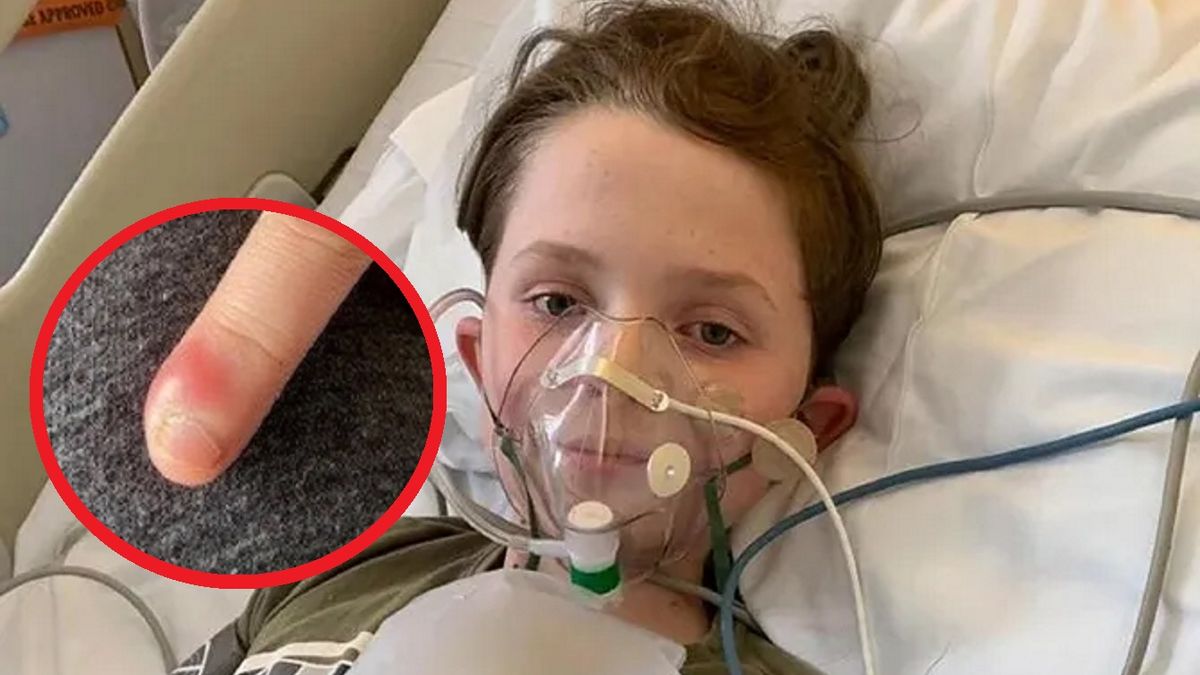 Jedynym objawem było obgryzanie paznokci. Diagnoza była szokiem